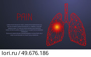 Human lungs surgery operation low poly. Medicine, disease, drug treatment, painful area. Polygonal human lungs with area of pain. Organ of human respiratory system. Bronchitis, pneumonia diagnostics. Polygonal lungs with painful area. Human respiratory system organ. Bronchitis, pneumonia diagnostics. Стоковая иллюстрация, агентство Ingram Publishing / Фотобанк Лори