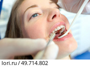 Open mouthed woman at the dentist. Стоковое фото, агентство Ingram Publishing / Фотобанк Лори