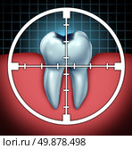 Fight cavities as a tooth cavity close up symbol with a target icon aiming at the oral disease as a health care concept for bone anatomy as a cure and dentist therapy for decay and rotting due to bacteria and acids. Стоковое фото, агентство Ingram Publishing / Фотобанк Лори