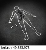 Heart attack medical concept as a chalk drawing of a human on a pavement floor with a cracked hole in the asphalt shaped as a cardiovascular system heart organ as a cardiology symbol of the dangers of bad diet and living a stress filled unhealthy lifestyle. Стоковое фото, агентство Ingram Publishing / Фотобанк Лори