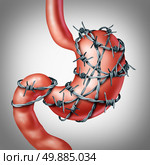 Stomach pain or stomachache and ulcer discomfort concept as a human digestive organ painfully wrapped with sharp barbwire as a medical healthcare stress and anxiety symbol of the painfull affliction in an abdominal internal organ. Стоковое фото, агентство Ingram Publishing / Фотобанк Лори