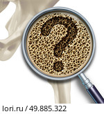Bone medical health questions and osteoporosis illustration concept as a close up diagram of the inside of human skeletal hip bones with a magnification glass showing a normal healthy condition degrading to abnormal unhealthy anatomy as a question mark. Стоковое фото, агентство Ingram Publishing / Фотобанк Лори