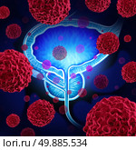 Prostate cancer danger medical concept as cancerous cells in a male body attacking the reproductive system as a symbol of human malignant tumor growth diagnosis treatment and risks.

. Стоковое фото, агентство Ingram Publishing / Фотобанк Лори