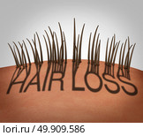 Hair loss and balding medical concept as a receding hairline with text as a shadow with thinning follicles on a mostly bald head as a 3D illustration. Стоковое фото, агентство Ingram Publishing / Фотобанк Лори