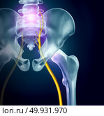 Sciatica pain symptoms and diagnosis medical concept as a disease causing physical problems with 3D illustration elements. Стоковое фото, агентство Ingram Publishing / Фотобанк Лори