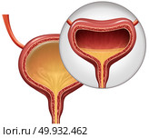 Overactive bladder and involuntary loss of urine concept as an uncomfortable condition in a human organ with 3D illustration elements. Стоковое фото, агентство Ingram Publishing / Фотобанк Лори