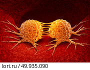 Dividing cancer cell metastasis division as a disease anatomy concept as a growing malignant tumor on an organ inside the human body as a 3D illustration.. Dividing Cancer Cell. Стоковое фото, агентство Ingram Publishing / Фотобанк Лори