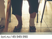 Legs of patients wearing a splint. Стоковое фото, агентство Ingram Publishing / Фотобанк Лори