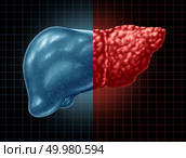 Fatty liver disease and hepatic steatosis body part as a medical health care concept of the digestive system anatomy and vital organ for digestion functions in a 3D illustration style. Стоковое фото, агентство Ingram Publishing / Фотобанк Лори