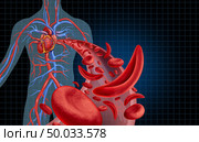 Sickle cell cardiovascular heart blood circulation and anemia as a disease with normal and abnormal hemoglobin in a human artery anatomy as a medical illustration concept with 3D illustration elements. Стоковое фото, агентство Ingram Publishing / Фотобанк Лори