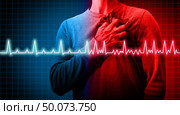 Heart disorder and atrial fibrillation ecg as a coronary cardiac attack with irregular and normal organ rythm as a chest discomfort disease concept with a person suffering from a circulation illness in a 3D illustration style. Стоковое фото, агентство Ingram Publishing / Фотобанк Лори