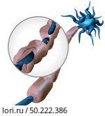 Multiple sclerosis diagram concept or MS autoimmune disease anatomy with healthy nerve and damaged myelin with exposed fibre with scarrred schwann cell sheath loss as a 3D illustration. Стоковое фото, агентство Ingram Publishing / Фотобанк Лори
