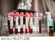 microbiologist with a tube of sample by Coronavirus with label Covid-19 / doctor in the laboratory for analysis and sampling of Covid-19 infectious disea. Стоковое фото, агентство Ingram Publishing / Фотобанк Лори
