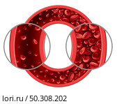 Anemia and anaemia medical diagram concept as normal and abnormal blood cell count and human circulation in an artery or vein as a 3D illustration isolated on a white background. Стоковое фото, агентство Ingram Publishing / Фотобанк Лори