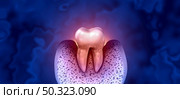 Tooth decay disease as an unhealthy molar with periodontitis due to poor oral hygiene health problem as a bacteria infection concept with inflammation as a 3D illustration on a blue background. Стоковое фото, агентство Ingram Publishing / Фотобанк Лори