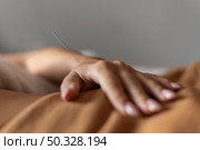 hand with acupuncture needle. High resolution photo. hand with acupuncture needle. Стоковое фото, агентство Ingram Publishing / Фотобанк Лори