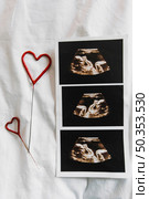 ultrasound image. Стоковое фото, агентство Ingram Publishing / Фотобанк Лори