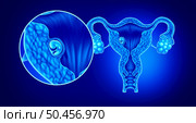 Implanted human embryo concept and successful pregnancy implantation in the uterus as a growing fetus in a female body as an obstetrics and gynecology symbol with 3D illustration elements. Стоковое фото, агентство Ingram Publishing / Фотобанк Лори