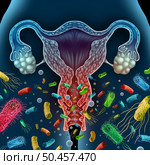 Bacterial Vaginosis concept as a vaginal inflammation caused by bacteria infection in the vagina with 3D illustration elements. Стоковое фото, агентство Ingram Publishing / Фотобанк Лори