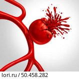 Ruptured Aneurysm as a medical concept with a bulging blood vessel as a ballooning artery with a rupture bleeding blood and causing a risk of hemorrhagic stroke as a 3D illustration. Стоковое фото, агентство Ingram Publishing / Фотобанк Лори