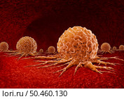 Malignant Cancer Growth and Metastasis anatomy concept as a growing tumor cell and Malignancy disease growth on an organ inside the human body as a 3D illustration. Стоковое фото, агентство Ingram Publishing / Фотобанк Лори