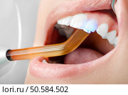 Dentist ultraviolet light pressed on teeth. Close up. Стоковое фото, агентство Ingram Publishing / Фотобанк Лори