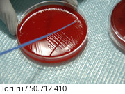 Staphylococcus Bacteria from human skin grown on agar. Стоковое фото, фотограф National Institutes of Health /Stocktrek/Stocktrek Images / ТАСС / Фотобанк Лори