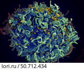 Scanning electron micrograph of HIV particles infecting a human H9 T cell. Стоковое фото, фотограф National Institutes of Health /Stocktrek/Stocktrek Images / ТАСС / Фотобанк Лори