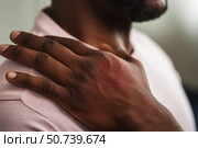 Close up of man touching sore shoulder experiencing pain. Стоковое AI-изображение, AI-художник Иван Рябоконь / Фотобанк Лори