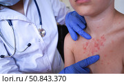 The boy's skin condition suggests an allergic reaction. Стоковое фото, фотограф Ирина Старикова / Фотобанк Лори