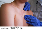 The physician is examining the boy for symptoms of smallpox-like illness. Стоковое фото, фотограф Ирина Старикова / Фотобанк Лори