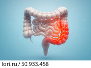 Anatomical Illustration of the Human Digestive System Highlighting the Colon and Intestines with Focus on Inflammation or Irritation in the Lower Gastrointestinal Tract. Стоковое AI-изображение, AI-художник Башкирова Анна / Фотобанк Лори