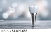 Dental implant showcasing advanced technology on a blurred background. Стоковое AI-изображение, AI-художник Katsiaryna Repich / Фотобанк Лори