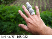 Man showing injured finger with splint in garden. Стоковое фото, фотограф Дмитрий Цветков / Фотобанк Лори