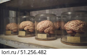 Brains are displayed in row of glass cases, each one illuminated, creating captivating visual effect. Стоковое AI-видео, аниматор Strunov David / Фотобанк Лори