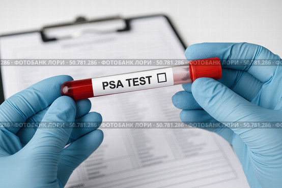 A Close-Up View of a Healthcare Professional Holding a Blood Sample Tube for a PSA Test, with a Medical Form in the Background. Стоковое AI-изображение, AI-художник Башкирова Анна / Фотобанк Лори