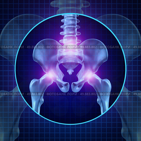 Back joint pain and human backache with skeleton showing the hip spine and vertebral column in glowing highlight as a medical health care concept for spinal surgery and therapy. Стоковое фото, агентство Ingram Publishing / Фотобанк Лори