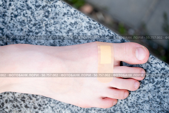 Beige plaster on a teenager's bare foot from a callus, close-up. Стоковое фото, фотограф Кашапова Эльвира / Фотобанк Лори