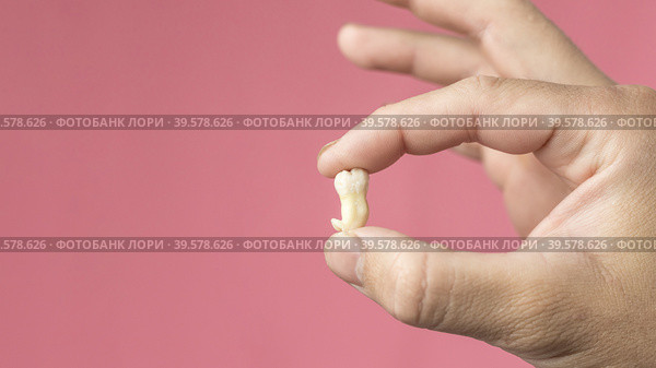 Close-up: a man's hand holds a removed wisdom tooth or a third molar on a pink background,copy space. Banner. Стоковое фото, фотограф Регина Ерофеева / Фотобанк Лори