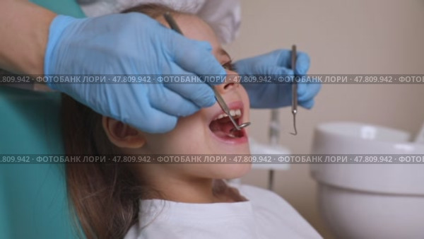 Close up dentist, doctor examines the oral cavity of a little girl, uses a mouth mirror, baby teeth close-up. Concept of pediatric dentistry, dental treatment. Slow motion footage. Стоковое видео, видеограф Ирина Михайличенко / Фотобанк Лори