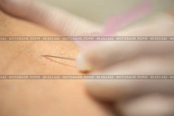 close up of syringe needle skin. Стоковое фото, агентство Ingram Publishing / Фотобанк Лори
