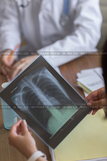Confident practitioner consulting woman in hospital. Explaining results of chest x-ray scan. Стоковое фото, агентство Ingram Publishing / Фотобанк Лори