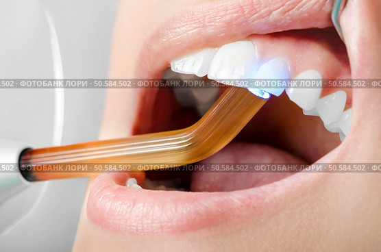Dentist ultraviolet light pressed on teeth. Close up. Стоковое фото, агентство Ingram Publishing / Фотобанк Лори