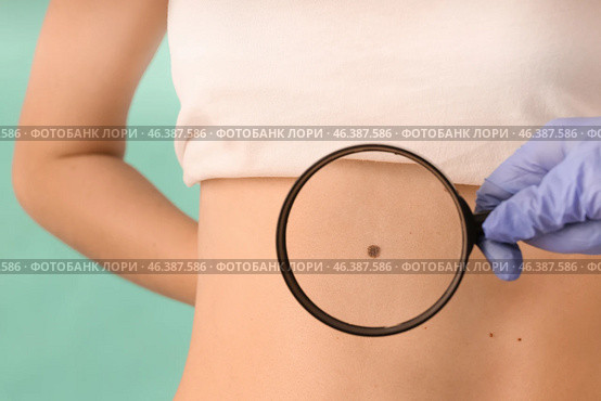 Dermatologist examining patient on color background, closeup. Стоковое фото, фотограф Pixel_shot / Фотобанк Лори