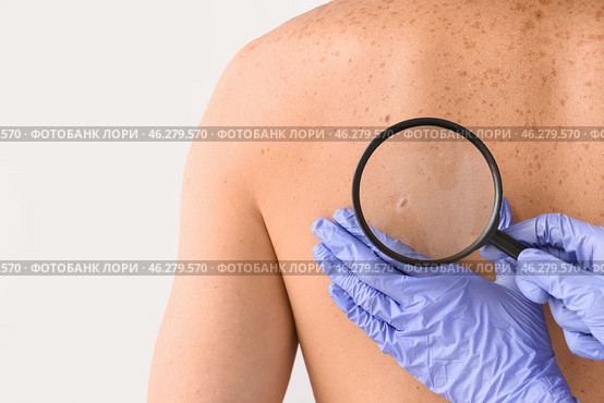 Dermatologist examining patient on light background. Стоковое фото, фотограф Pixel_shot / Фотобанк Лори