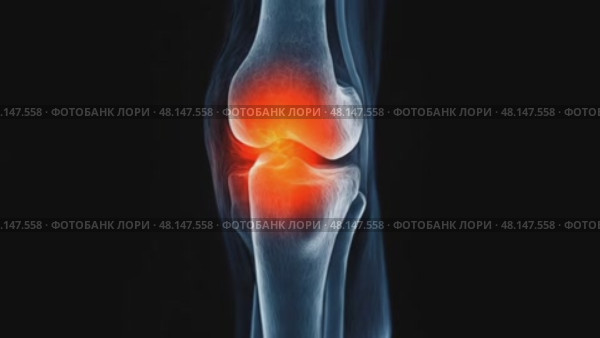 Dynamic xray knee joint with highlighted inflammation showing internal movement. Стоковое AI-видео, аниматор Владимир Федоров / Фотобанк Лори