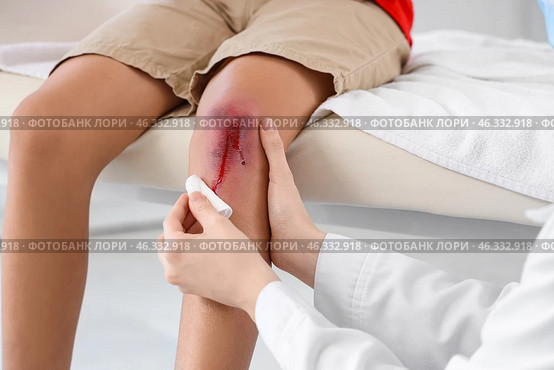 Female doctor disinfecting wound on little boy's knee in clinic, closeup. Стоковое фото, фотограф Pixel_shot / Фотобанк Лори