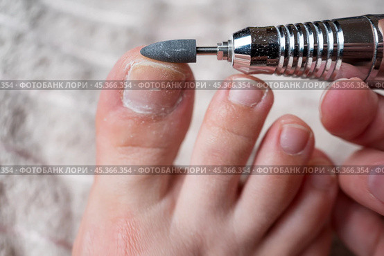 Hardware pedicure for yourself, ingrown toenail, chiropody and podology concept, foot care. Стоковое фото, фотограф Станислав Тарко / Фотобанк Лори