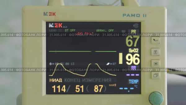 Хирургия. Медицинский монитор. Surgery. Medical monitor. (2019 год). Редакционное видео, видеограф Евгений Романов / Фотобанк Лори