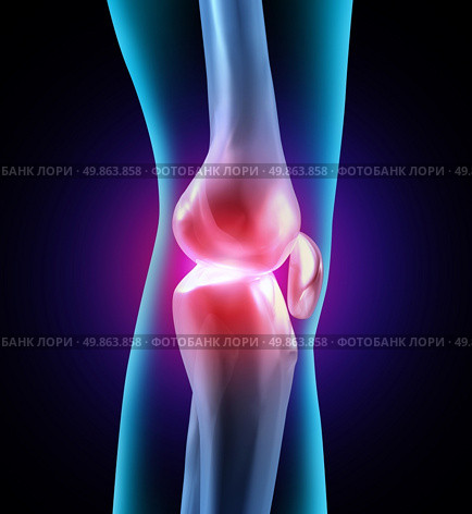 Joint discomfort and painful human joints as a medical illustration with bone anatomy and see through body part showing health care problems with flexibility and arthritis related orthopedic needing doctor assisted therapy. Стоковое фото, агентство Ingram Publishing / Фотобанк Лори